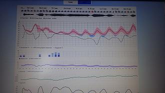 Нажмите на изображение для увеличения.  Название:	20260404_152252.jpg Просмотров:	0 Размер:	344.0 Кб ID:	4559068