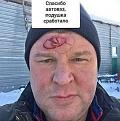 Нажмите на изображение для увеличения.

Название:	391751755_634317212202711_3042399129860827003_n.jpg
Просмотров:	1449
Размер:	125.6 Кб
ID:	4490133
